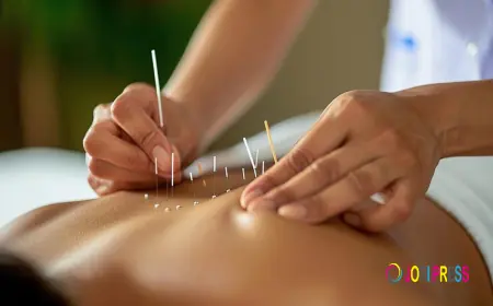 Benefits of Acupuncture Treatment for Pain Relief and Wellness