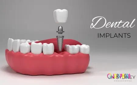 Dental Implant Cost Sydney: How to Plan Your Budget