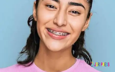Ceramic Braces in Dubai: Are They the Right Choice for a Straighter Smile?