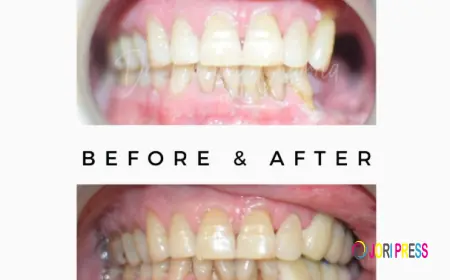 Comprehensive Oral Cancer Treatment Jaipur: From Precision Detection to Advanced Rehabilitation