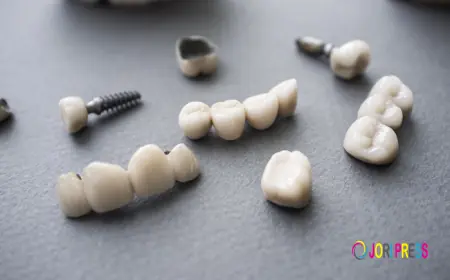 PFM Crowns and Bridges in Dubai – Durable and Natural-Looking Tooth Restoration
