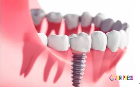 Dental Implants in Boronia — What Local Patients Actually Need to Know Before Booking Anything