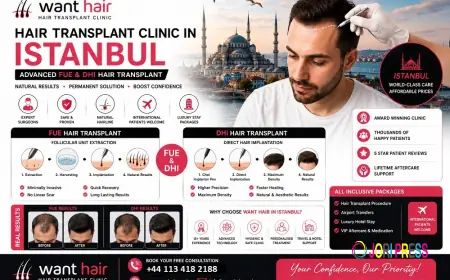 Want Hair Ltd Shares Expert Insights on Achieving Natural Results with Hair Transplant Turkey
