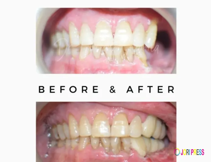 Comprehensive Oral Cancer Treatment Jaipur: From Precision Detection to Advanced Rehabilitation