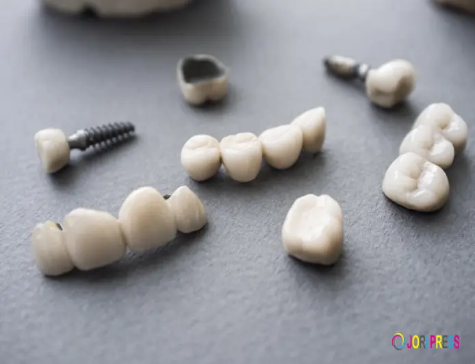 PFM Crowns and Bridges in Dubai – Durable and Natural-Looking Tooth Restoration