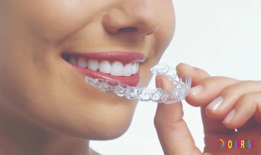 Clear Aligners Doctors in Bikaner: Expert Guidance for a Straighter, Healthier Smile
