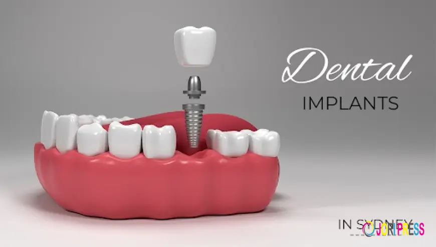 Dental Implant Cost Sydney: How to Plan Your Budget