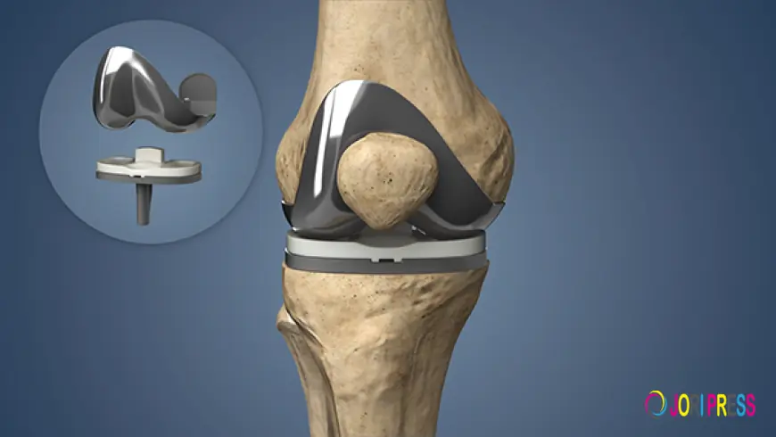 Regain Your Mobility with Expert Total Knee Replacement in Faridabad
