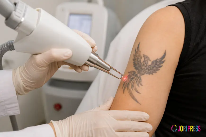 Tattoo Removal in Sharjah: Safe Laser Treatment for Unwanted Tattoos