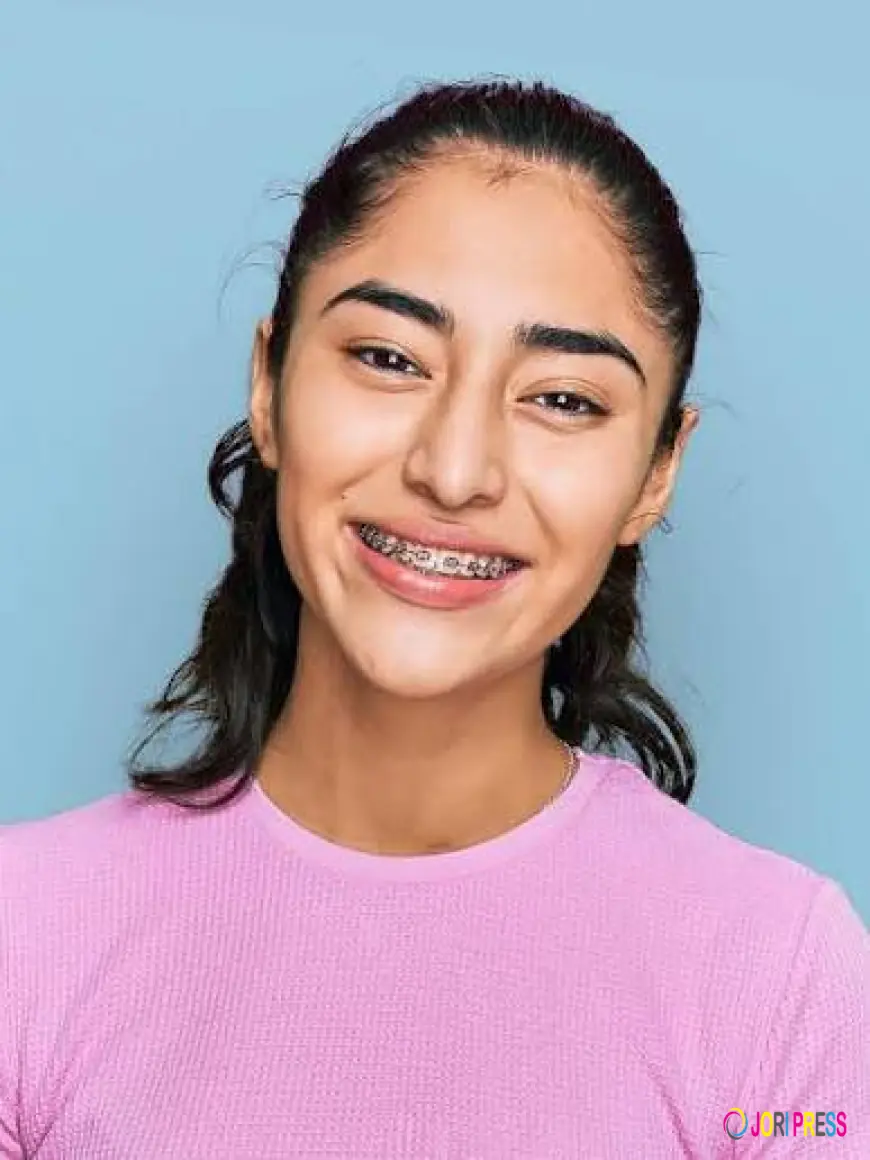 Ceramic Braces in Dubai: Are They the Right Choice for a Straighter Smile?