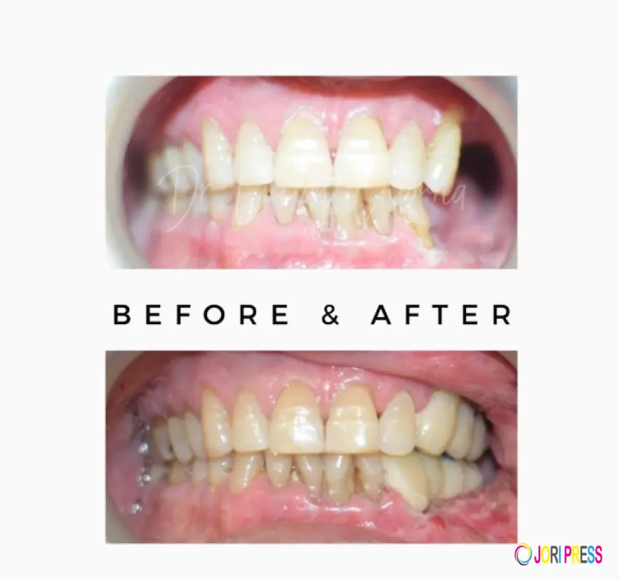 Comprehensive Oral Cancer Treatment Jaipur: From Precision Detection to Advanced Rehabilitation