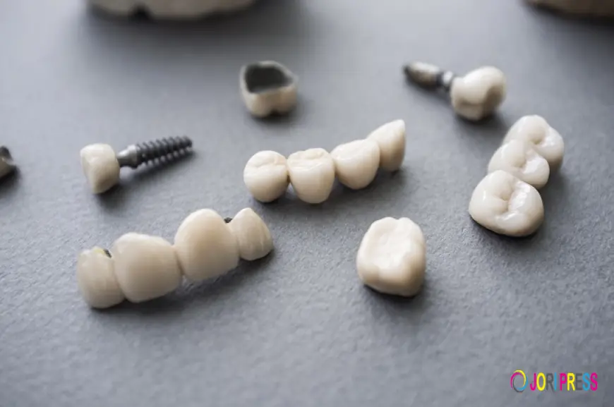 PFM Crowns and Bridges in Dubai – Durable and Natural-Looking Tooth Restoration