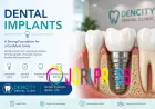 Dental Implant Specialist: Your Complete Guide to a Confident Smile