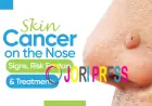 What to Do If You Have Skin Cancer on the Nose?