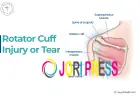 Signs and Symptoms of Torn Rotator Cuff