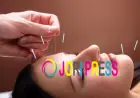 Advanced Acupuncture Brings Personalized Acupuncture Care to Hallandale Beach FL