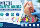Diabetic Foot Wound Infection: Prevention and Recovery Guide
