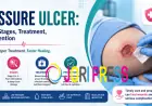 How to Prevent and Manage Pressure Ulcers Effectively?