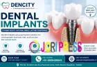 Best Dental Implant Clinic in Bikaner: Everything You Need to Know About Dental Implants