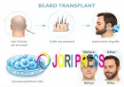 A Complete Guide to Choosing the Right Beard Transplant Near Me