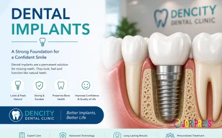 Dental Implant Specialist: Your Complete Guide to a Confident Smile