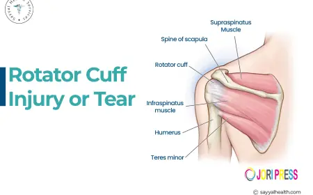 Signs and Symptoms of Torn Rotator Cuff