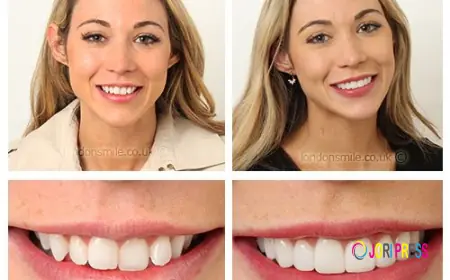 The London Smile Clinic