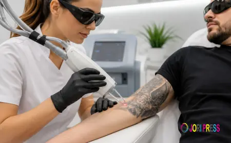 Tattoo Removal in Sharjah: Safe Laser Treatment for Unwanted Tattoos