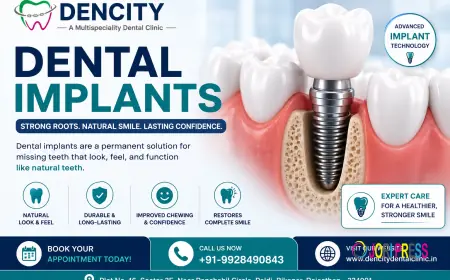 Best Dental Implant Clinic in Bikaner: Everything You Need to Know About Dental Implants