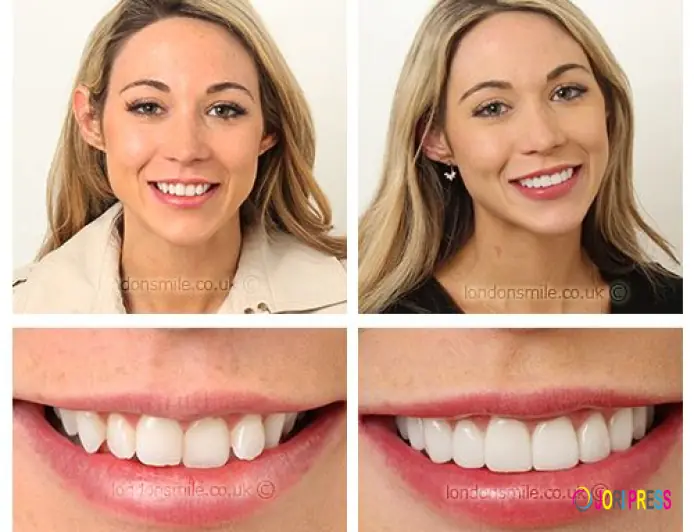 The London Smile Clinic
