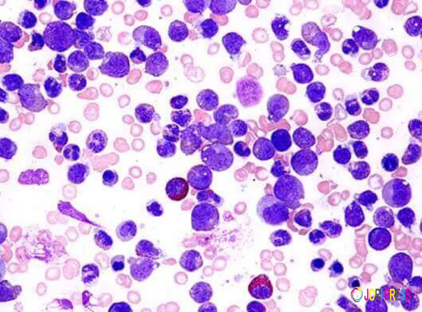 Chronic Myelomonocytic Leukemia Market Size and Emerging Growth Trends