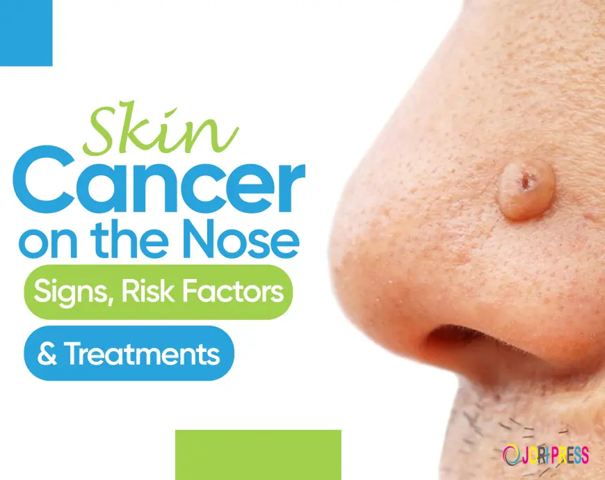 What to Do If You Have Skin Cancer on the Nose?