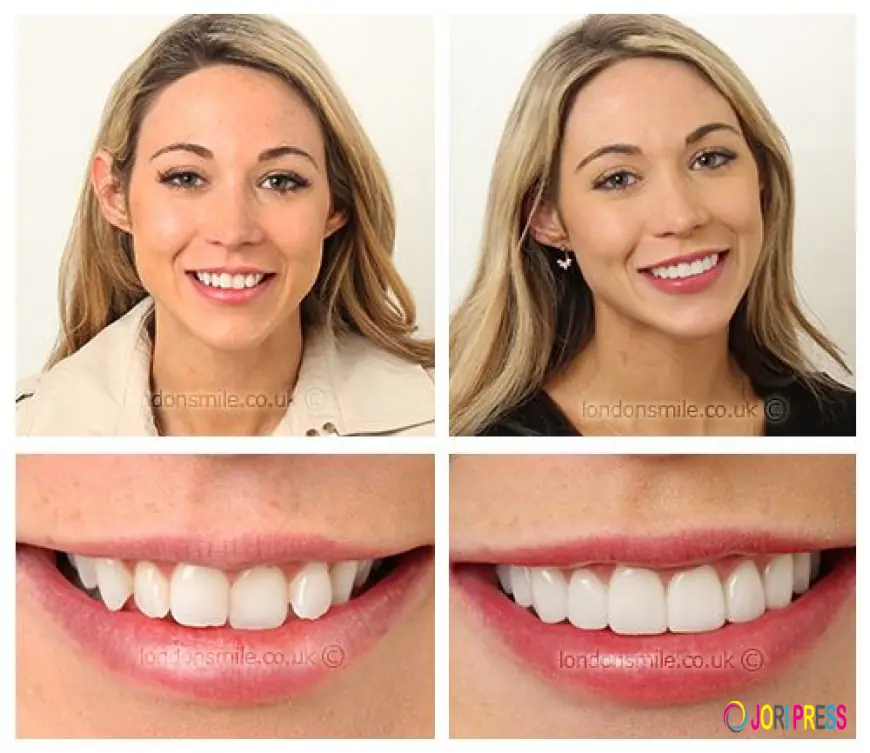 The London Smile Clinic