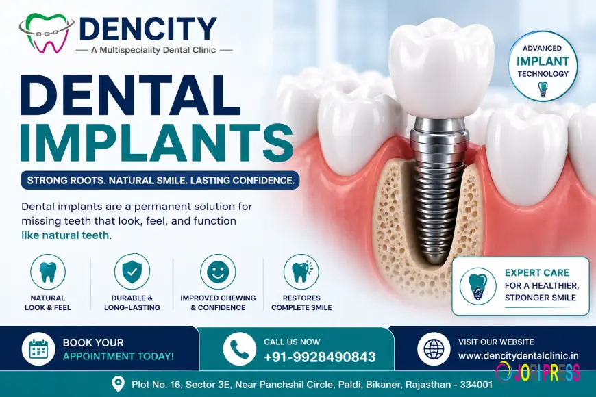 Best Dental Implant Clinic in Bikaner: Everything You Need to Know About Dental Implants