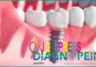 Dental Clinic in Mumbai Offering Affordable Smile Enhancement Services