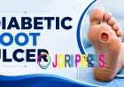 The Complete Guide to Diabetic Foot Ulcer Care and Recovery