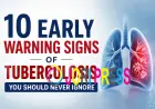 10 Early Warning Signs of Tuberculosis You Should Never Ignore