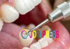 Price of Dental Cap: Full Cost & Types Guide