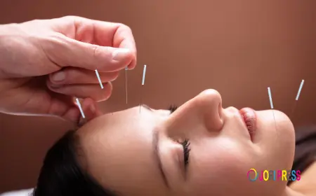 Advanced Acupuncture Focuses on Personalized Healing for the Miami Beach Community