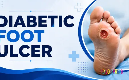 The Complete Guide to Diabetic Foot Ulcer Care and Recovery