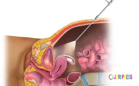 Hysteroscopy Specialist Zirakpur: Understanding the Procedure and Its Benefits