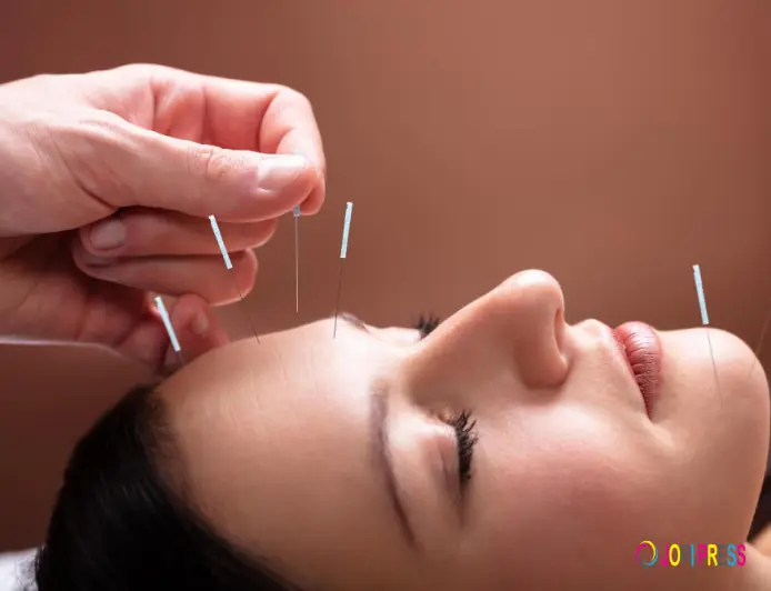 Advanced Acupuncture Focuses on Personalized Healing for the Miami Beach Community