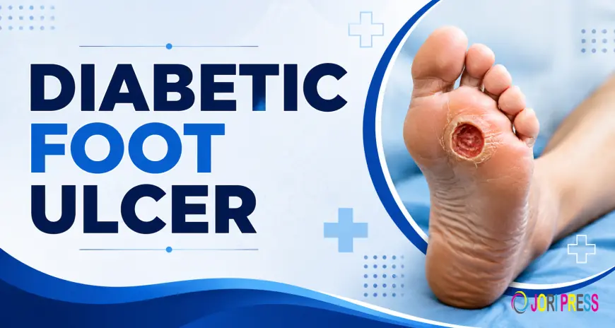 The Complete Guide to Diabetic Foot Ulcer Care and Recovery