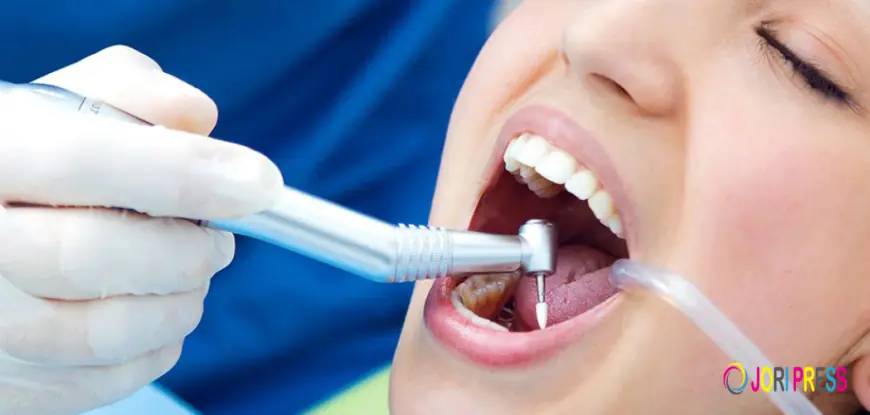 What Is a Dental Prophy? A Guide to Preventive Teeth Cleaning