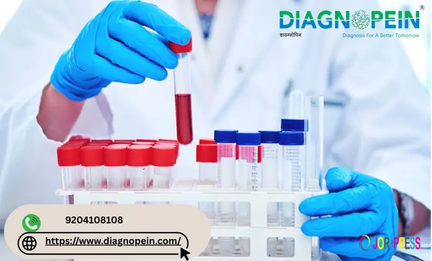 Vitamin B12 Blood Test in Pune | Convenient & Reliable Lab Test