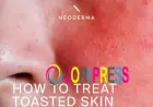 Heat Rash on Face: Causes, Symptoms, Treatment, and Prevention