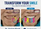 Looking for "Dental Implants Near Me"? Here's Everything You Need to Know Before You Choose