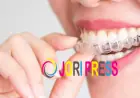 Elegant Smiles Offers SimplyClear Aligners in Atlanta for a Discreet Approach to Teeth Straightening