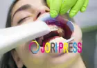 Maple Lake Braces: What Should You Know Before Choosing Braces?