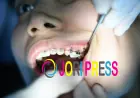 Cokato Braces: What to Know Before Starting Orthodontic Treatment